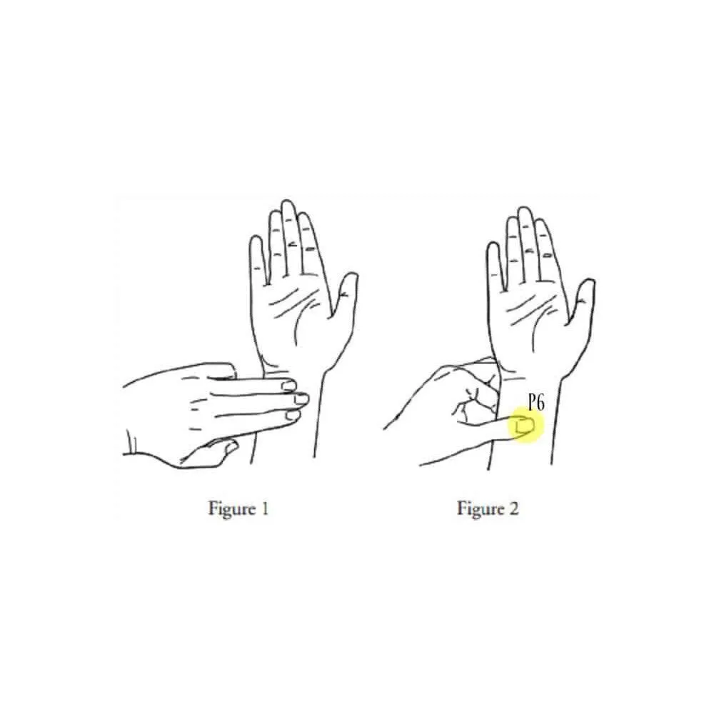 Nausea Relief Bands - Minor Imperfections